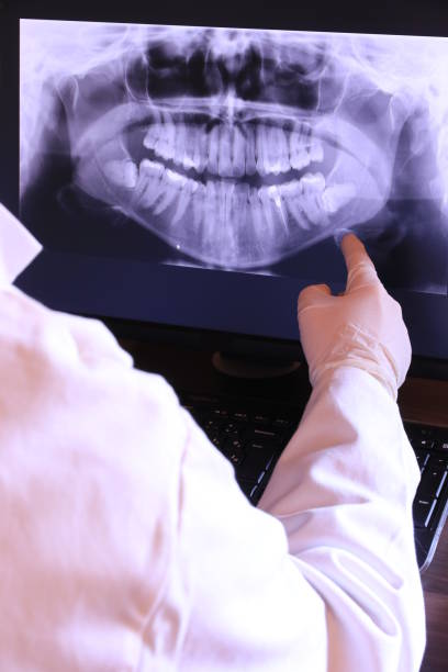 Best Dental Abscess Treatment in Green Cove Springs, FL